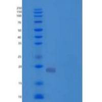 人血红蛋白亚单位ζ/HBAZ重组蛋白N-6His