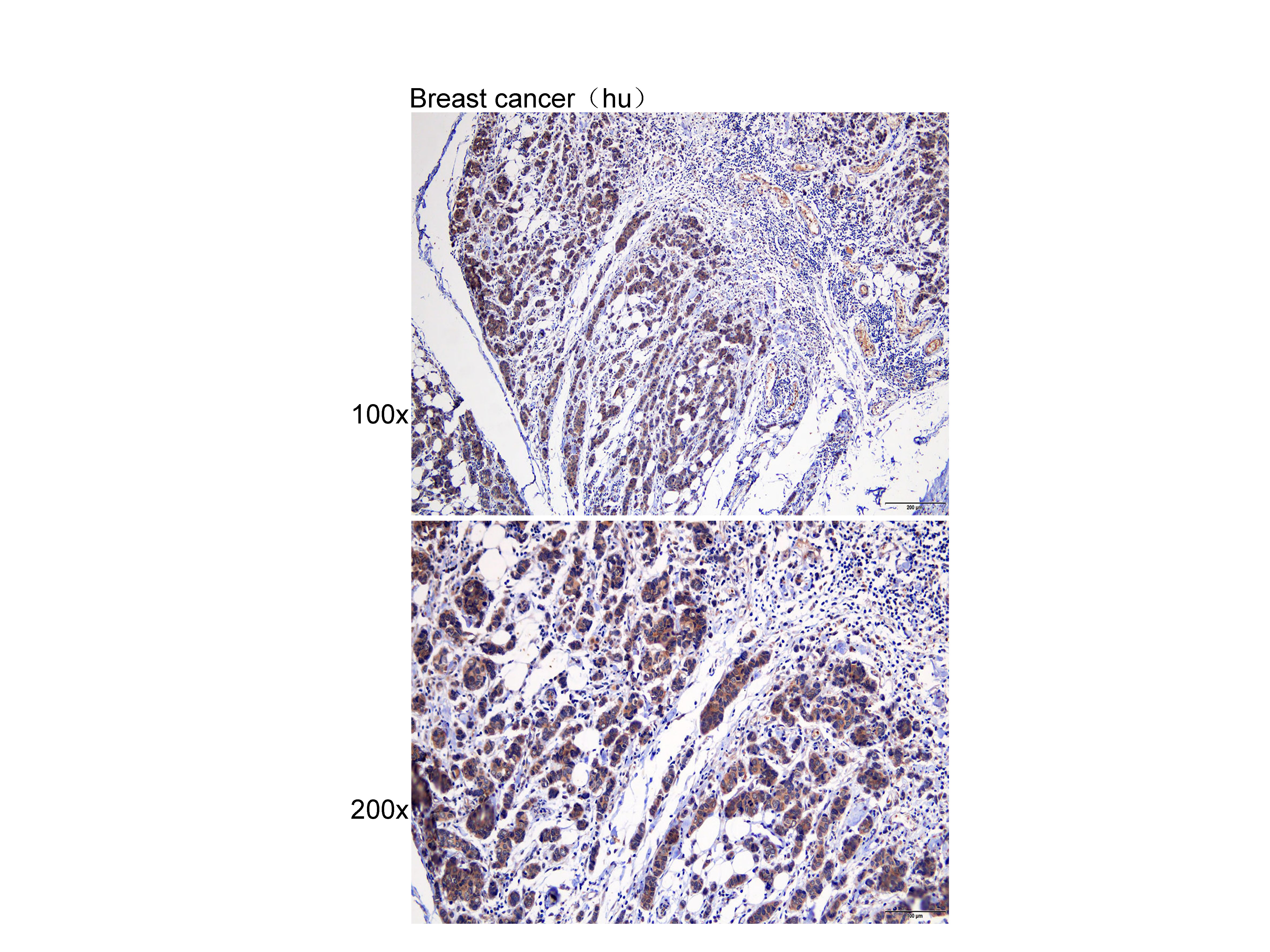 Anti-PAR4 Polyclonal Antibody