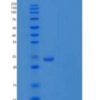 人突触小泡蛋白同源物YKT6/YKT6重组蛋白N-6His