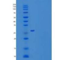 小鼠颗粒酶D(GZMD)重组蛋白C-6His