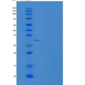 小鼠颗粒酶B（G，H）/GZMB重组蛋白C-6His