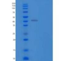 人畸胎瘤衍生生长因子1/tdg f1/转录重组蛋白C-Fc