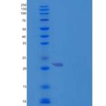 人组织金属蛋白酶抑制因子4(TIMP4)重组蛋白C-6His