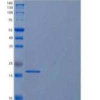 人U6 snRNA相关Sm样蛋白LSm1/LSM1重组蛋白C-6His