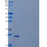 人抑制素βC(INHbC)重组蛋白N-6His