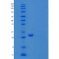 人Partner of Y14 and Mago/WIBG /PYM重组蛋白C-6His