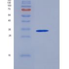 人硫氧还蛋白结构域蛋白15/TXNDC15重组蛋白C-6His