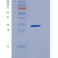 人硫氧还蛋白结构域蛋白15/TXNDC15重组蛋白C-6His