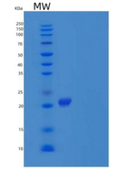 小鼠白细胞介素1受体拮抗蛋白/白细胞介素1ra/白细胞介素1