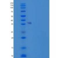人血小板生成素(TPO)重组蛋白N, C-6His