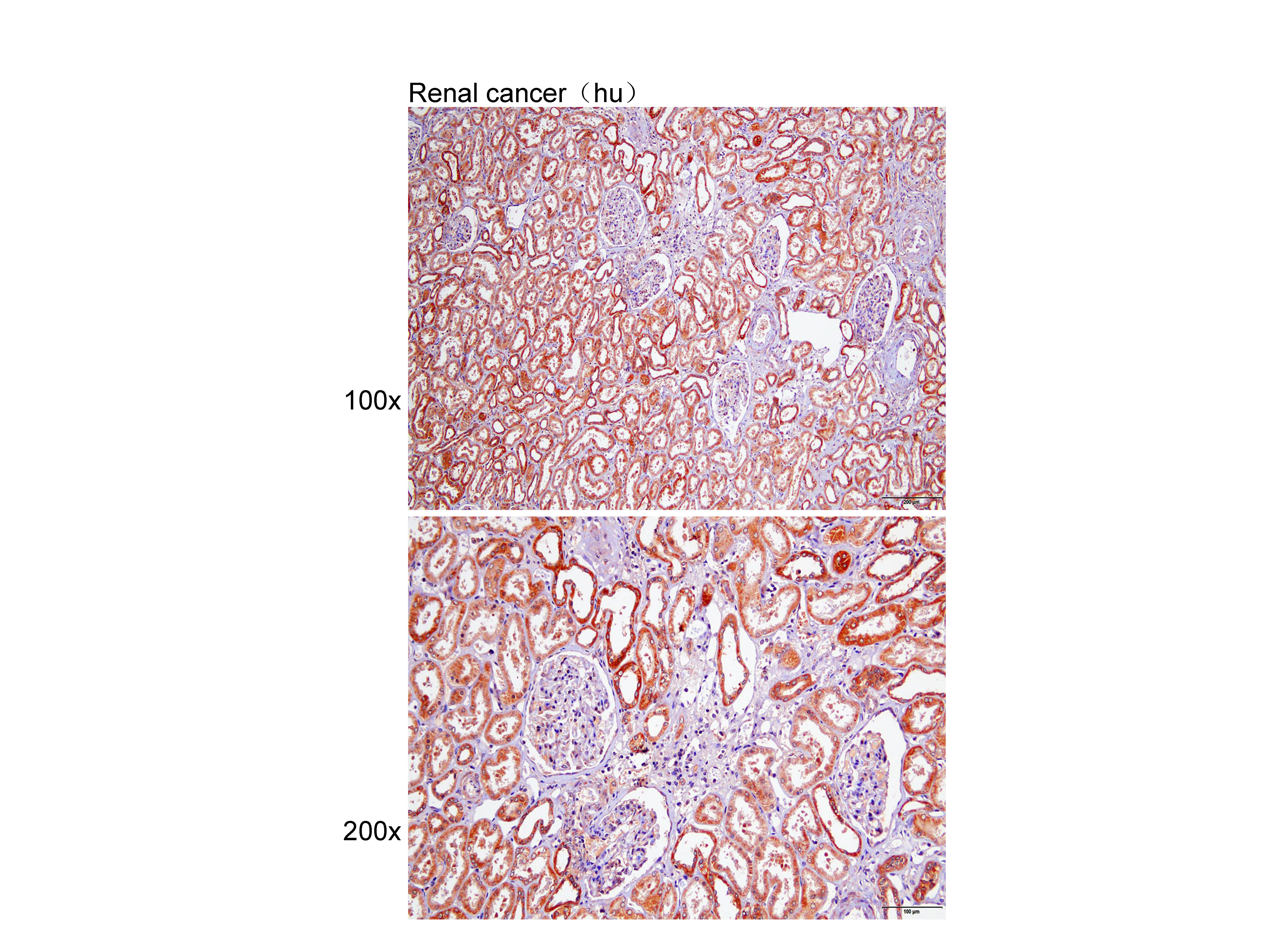 Anti-GDNFRA Polyclonal Antibod
