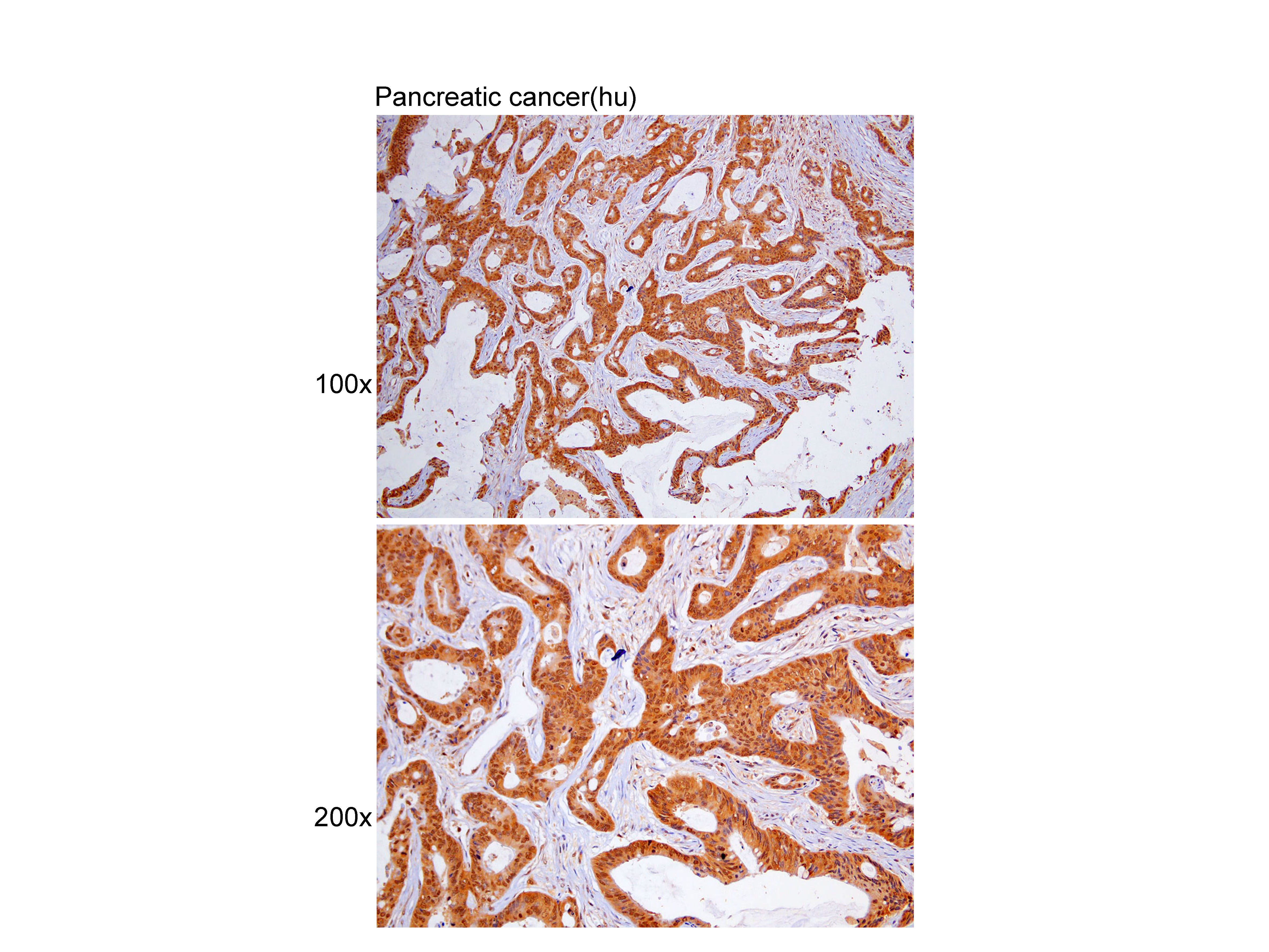 Anti-SQSTM1 Polyclonal Antibod