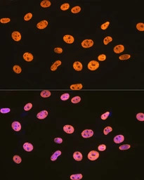 hnRNP U antibody [GT1242]