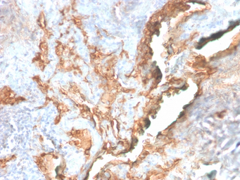 Tenascin C antibody [TNC/2981R
