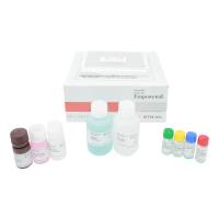 白喉/百日咳/破伤风IgG检测试剂盒（ELISA）