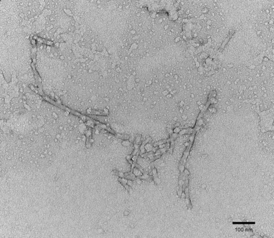 stressmarq热销产品Tau Protein