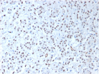 Wilms Tumor 1 antibody [WT1/14
