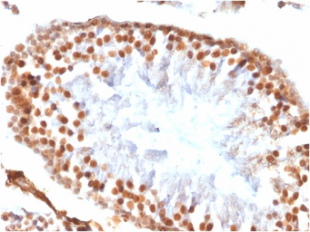 Wilms Tumor 1 antibody [WT1/14