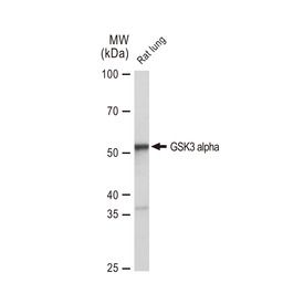 GSK3 alpha antibody [GT1264]