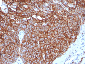 GluT1 antibody [GLUT1/3132R]