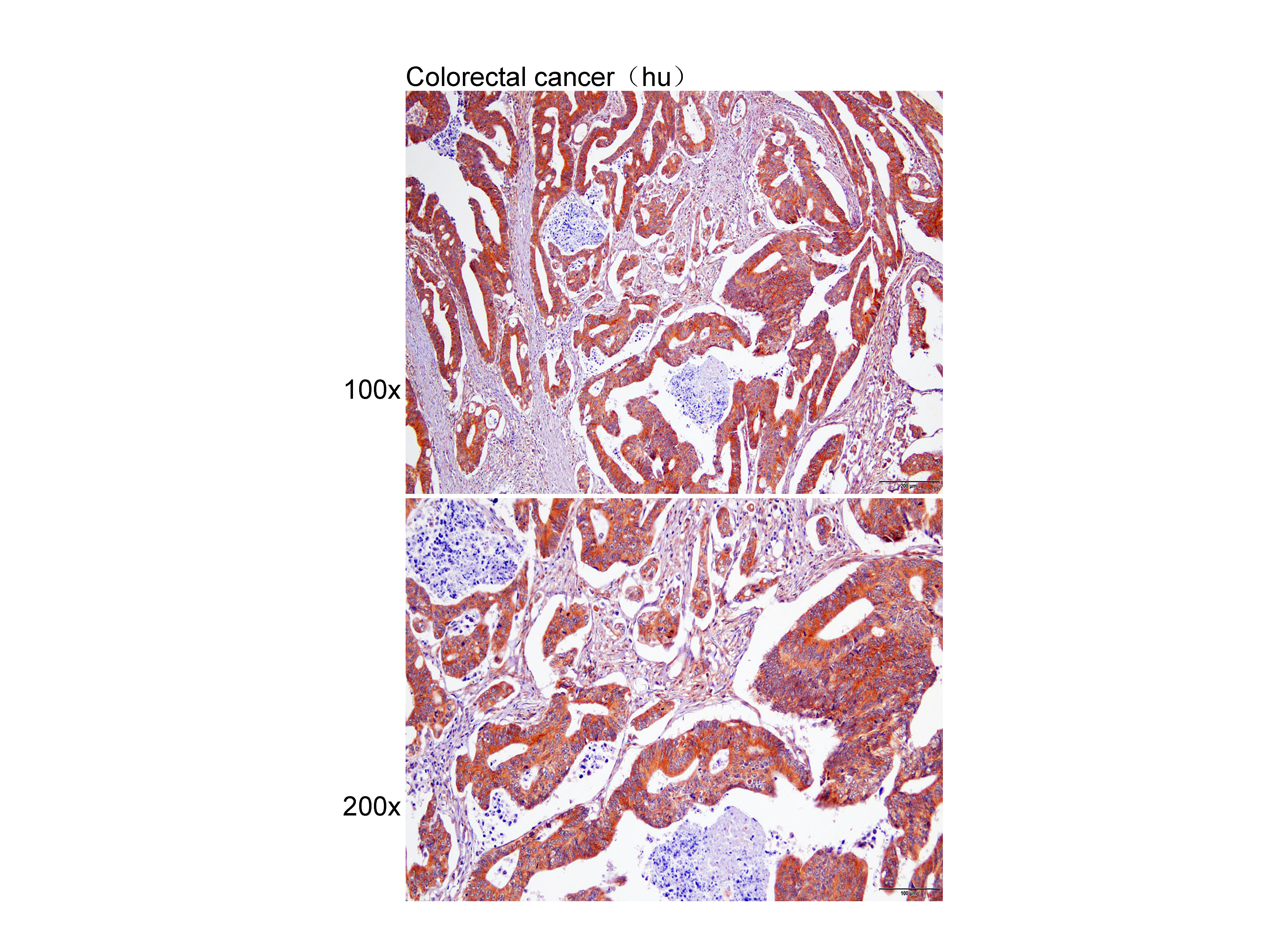 Anti-GDNFRA Polyclonal Antibod