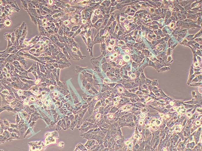 SW756 人子宫鳞状癌细胞