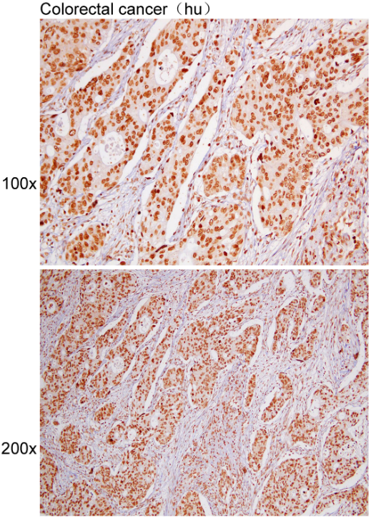 Anti-HIST3H3 Polyclonal Antibo