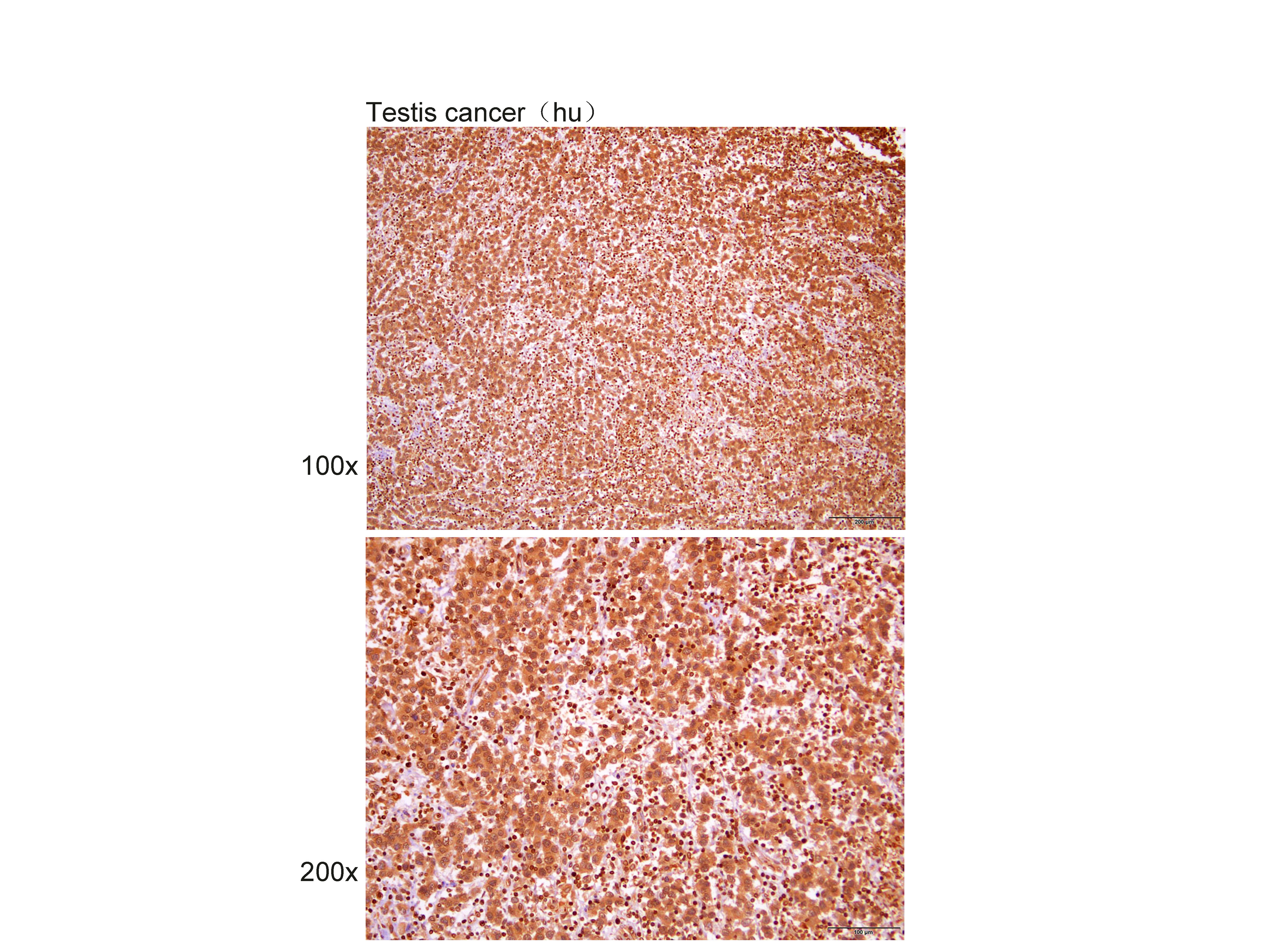 Anti-LKB1 Polyclonal Antibody