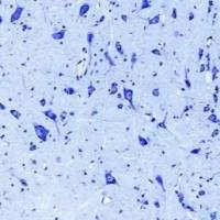 上海尼氏染色实验