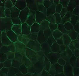 E-Cadherin antibody [DECMA-1]