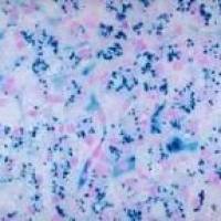 铁血黄素染色实验