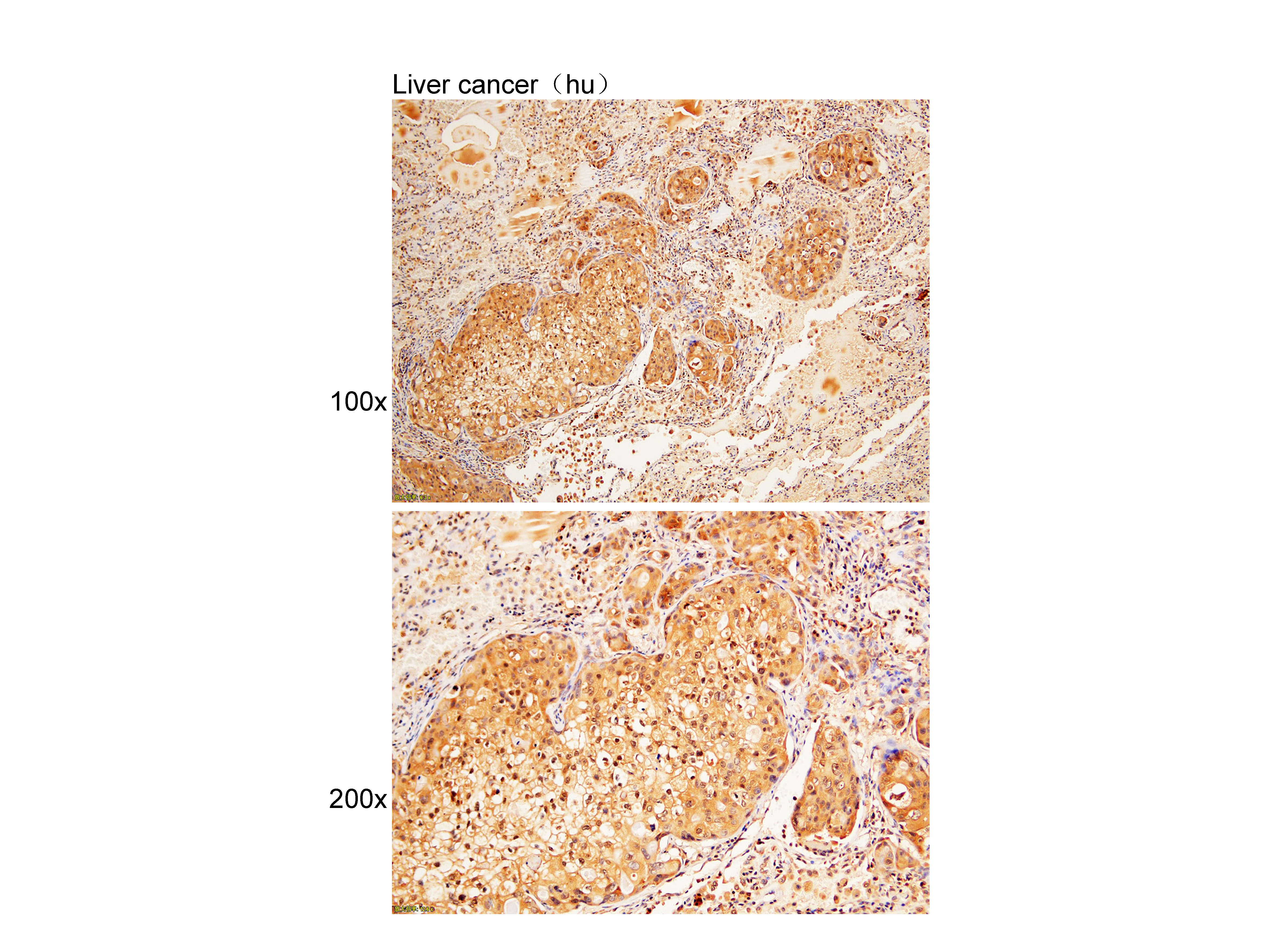 Anti-PGH2 Polyclonal Antibody
