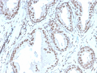 ATRX antibody [rATRX/3446]
