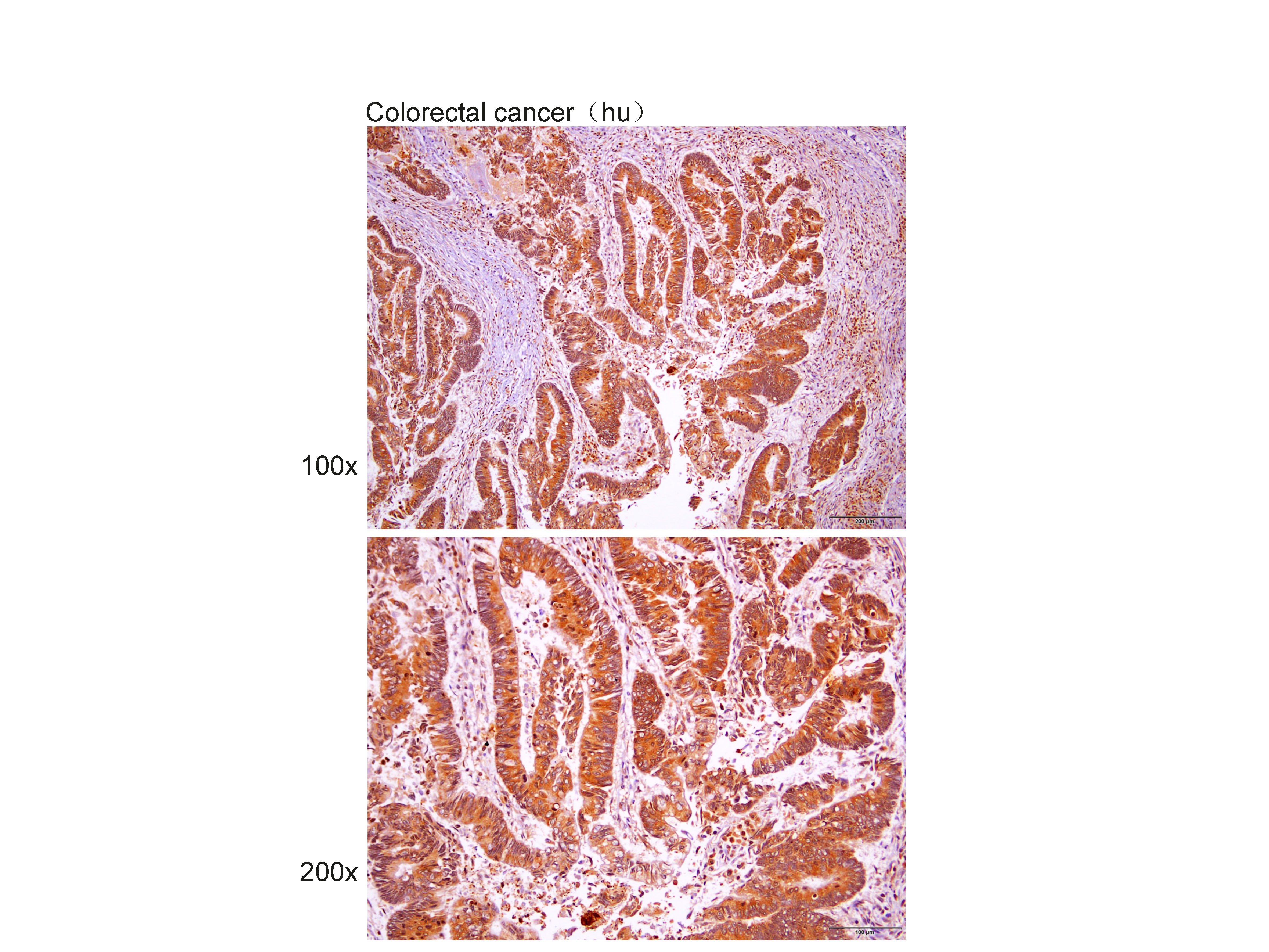 Anti-LKB1 Polyclonal Antibody