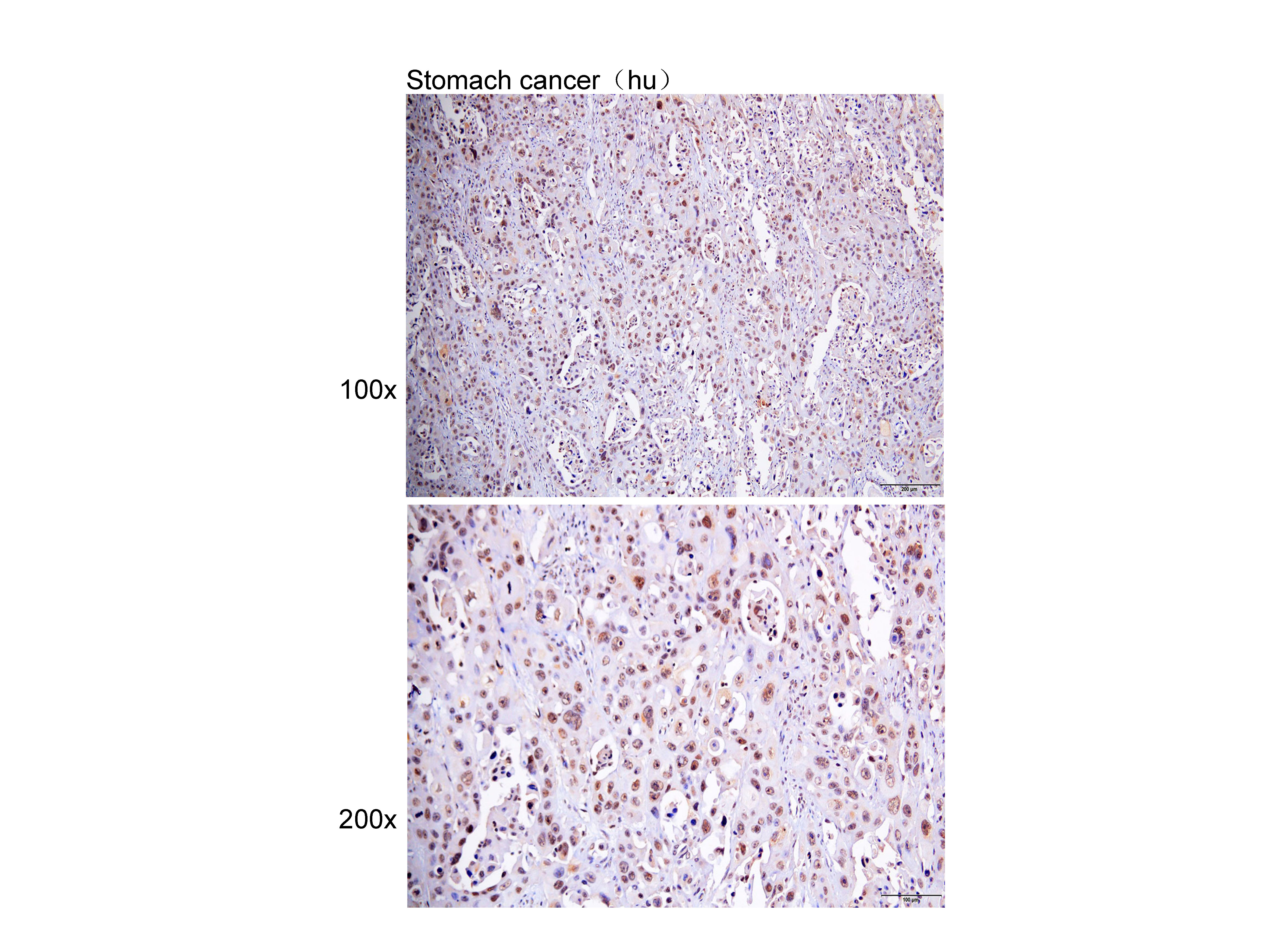 Anti-ELAVL1G Polyclonal Antibo