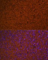 Hemoglobin alpha antibody [GT1