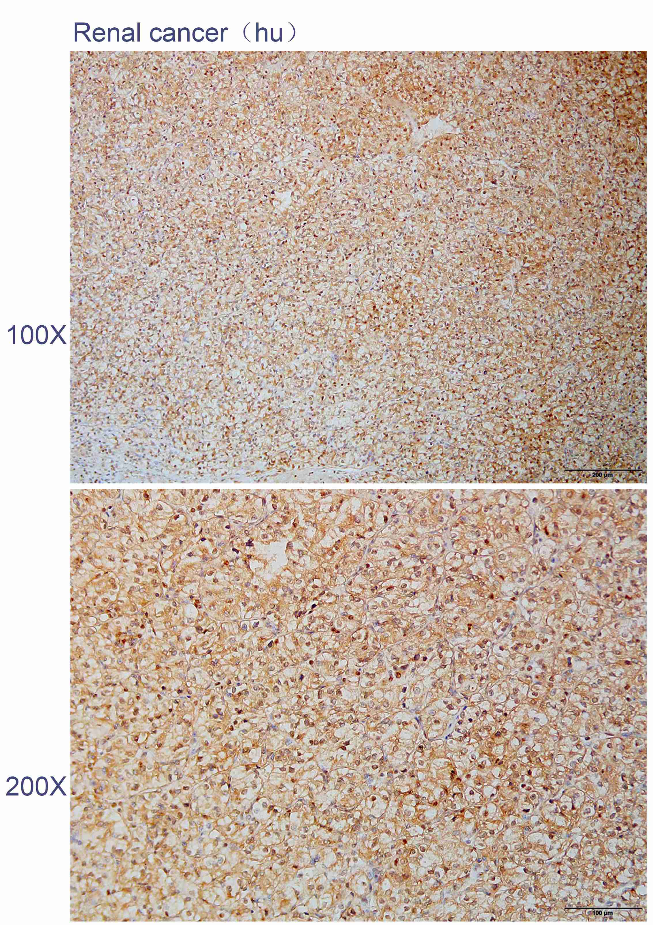 Anti-APH1A Polyclonal Antibody