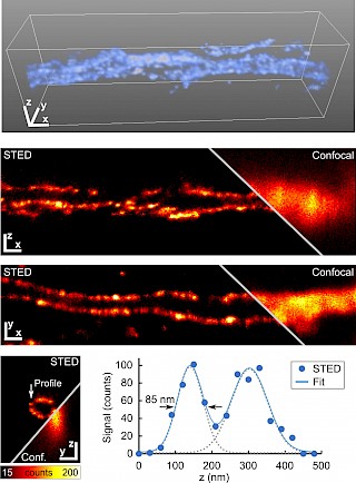 Infinity Line-STED超高分辨率显微镜