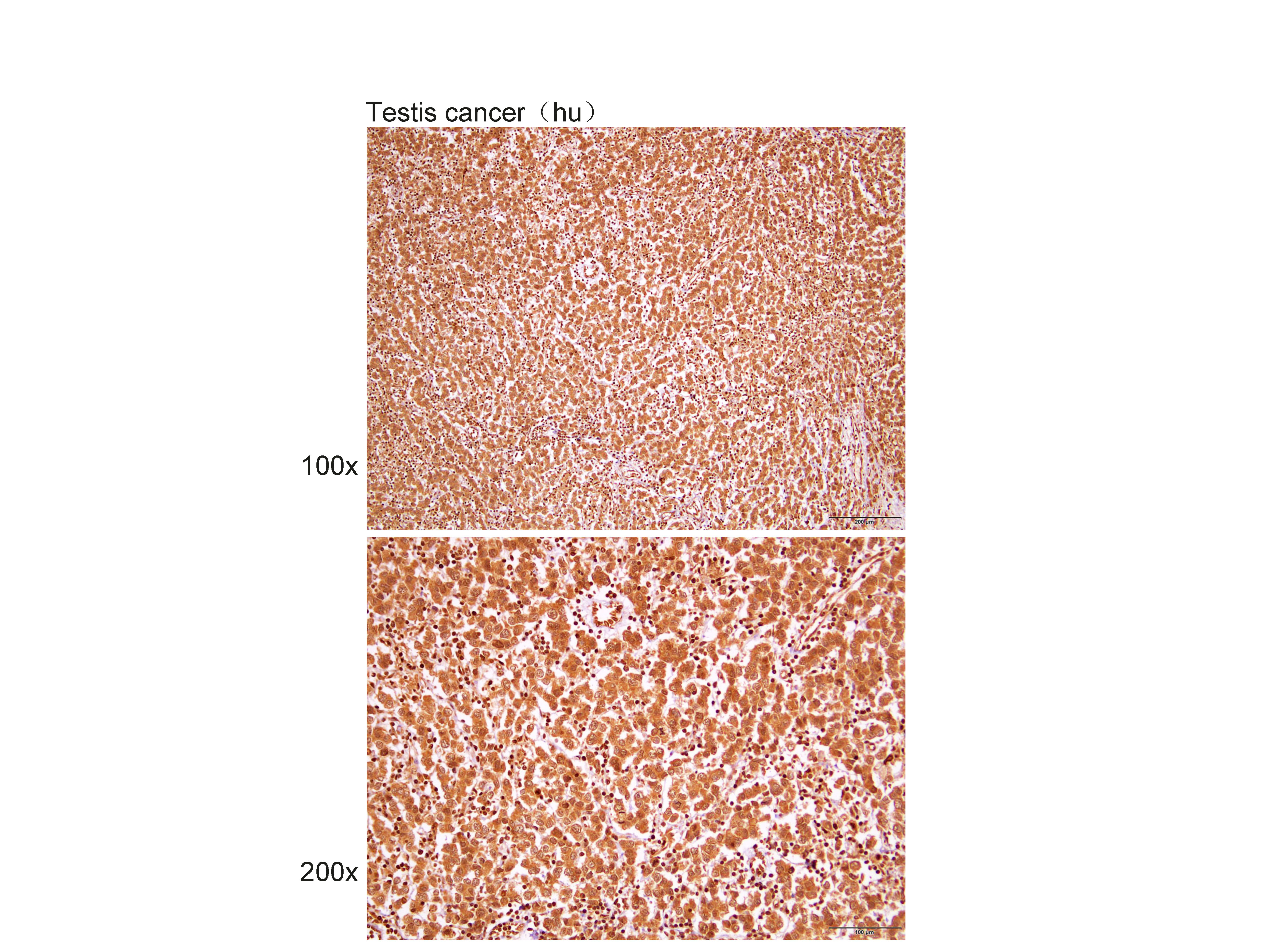 Anti-LRP6 Polyclonal Antibody