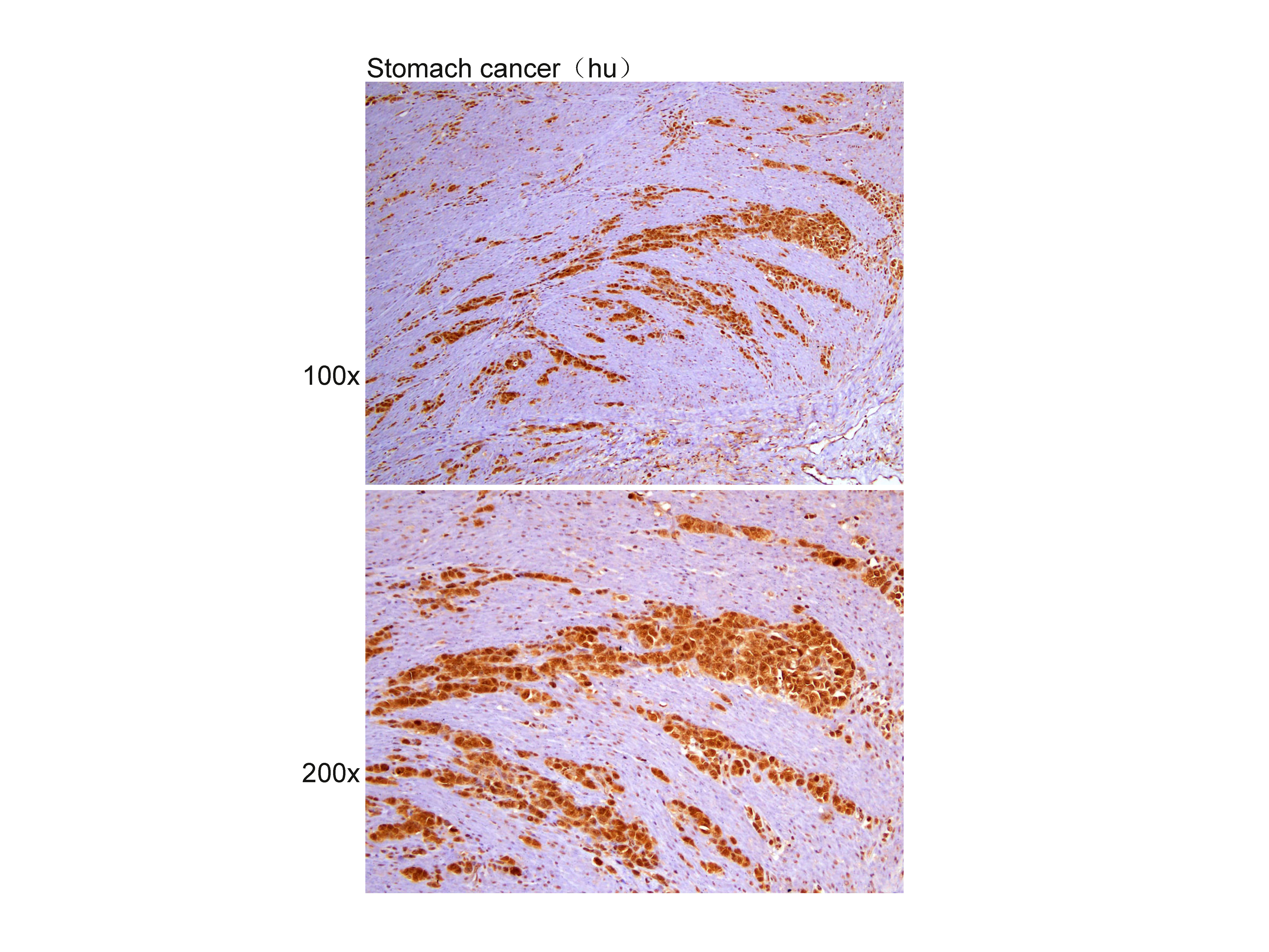 Anti-FREAC3 Polyclonal Antibod