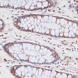 CDKN2A / p16INK4a antibody