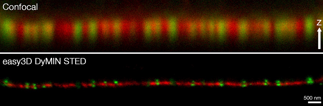 Infinity Line-STED超高分辨率显微镜