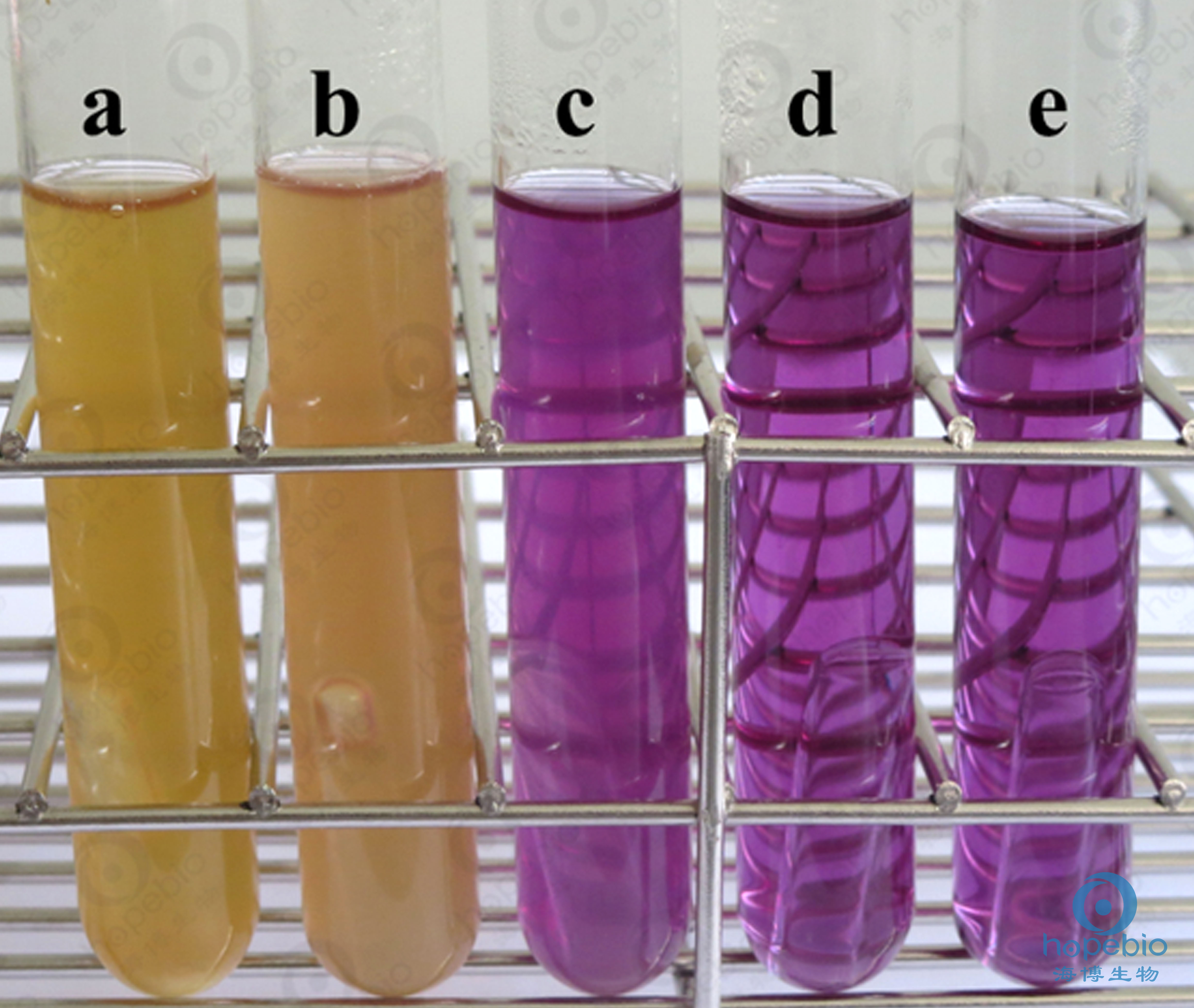 乳糖胆盐发酵培养基