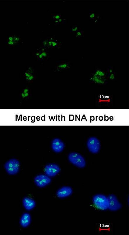 RASSF2 antibody - SAB | Signalway Antibody