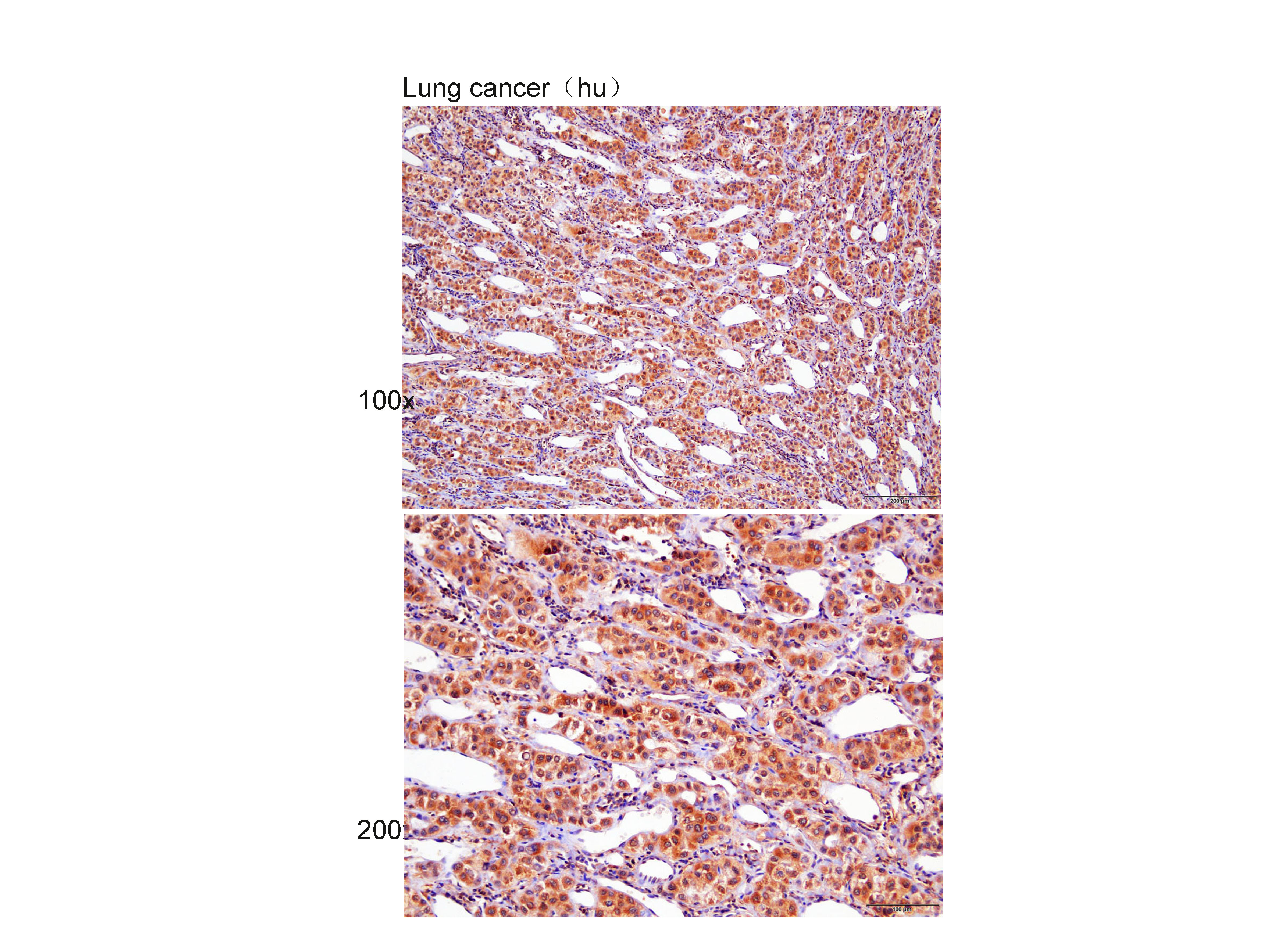 Anti-Visfatin Polyclonal Antib