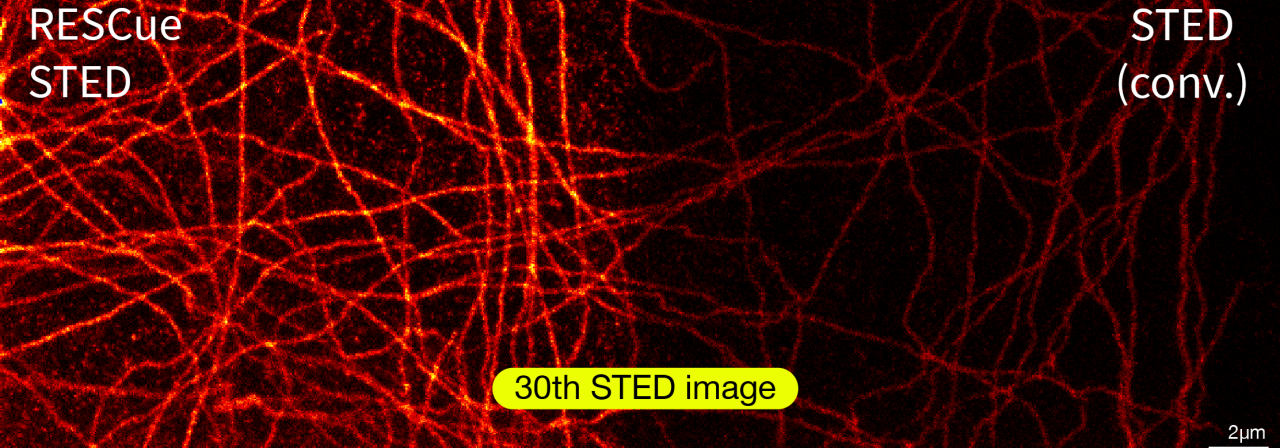 Infinity Line-STED超高分辨率显微镜