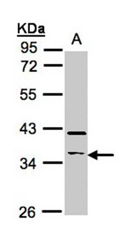 RASSF2 antibody - SAB | Signalway Antibody