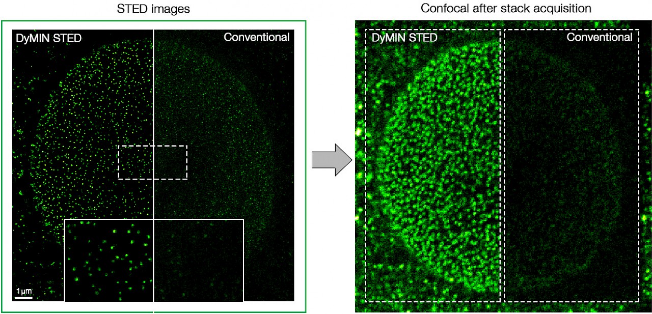 Infinity Line-STED超高分辨率显微镜