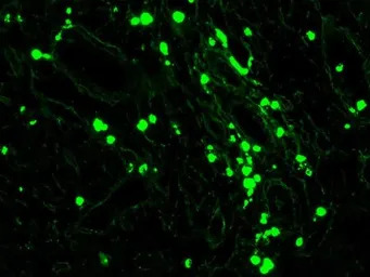 Mouse anti-Human IgA + IgG + I