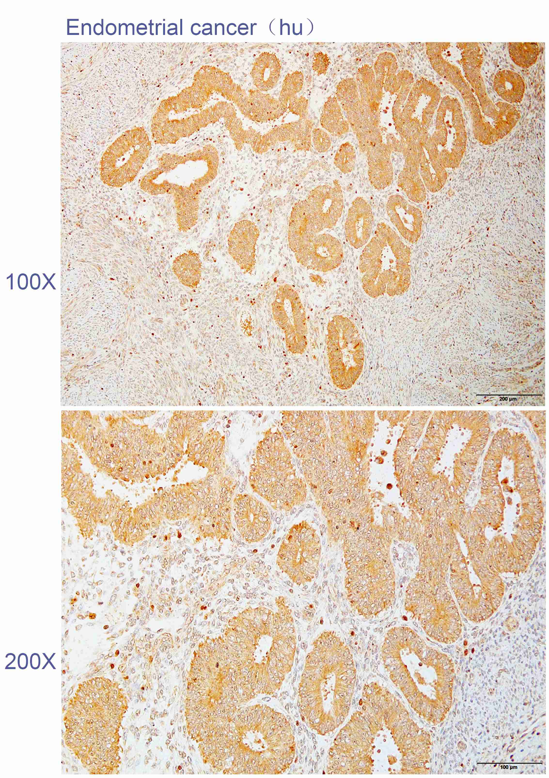 Anti-APH1A Polyclonal Antibody